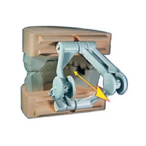 BLOQUEADOR VERTICAL ORBIX 2u. — Innvori Dental
