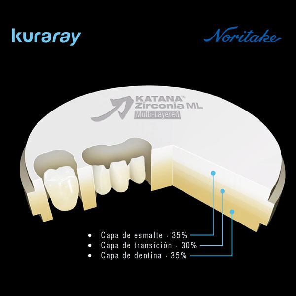 KATANA ZR HTML D2 COLLAR T:14MM (antes 125-7272) — NORITAKE — Innvori Dental